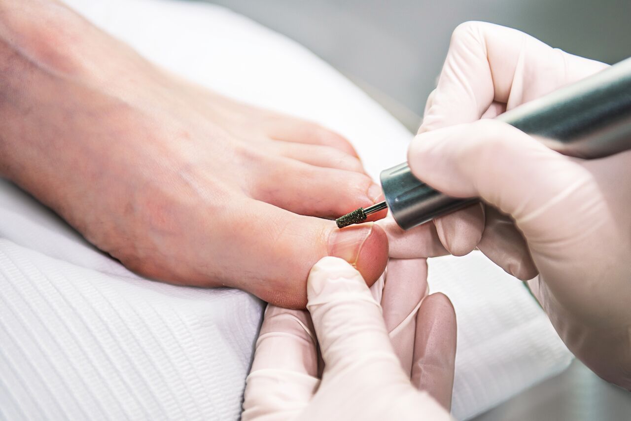 Świąteczne Ryzyko Podologiczne: Jak Uratować Swoje Stopy Przed Balową Katastrofą!