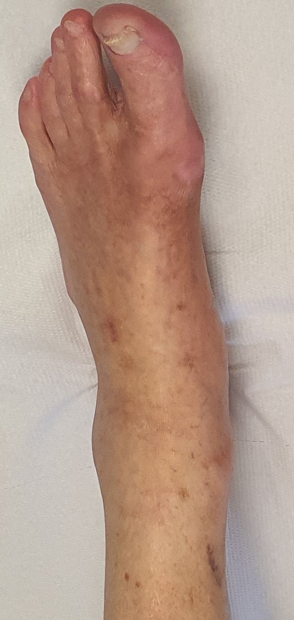 Witamina E w podologii – składnik zdrowej skóry stóp